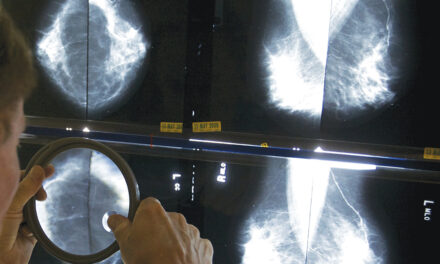 Breast Cancer Is On The Rise In Women In Their 40s. Earlier  Mammograms May Help Catch It