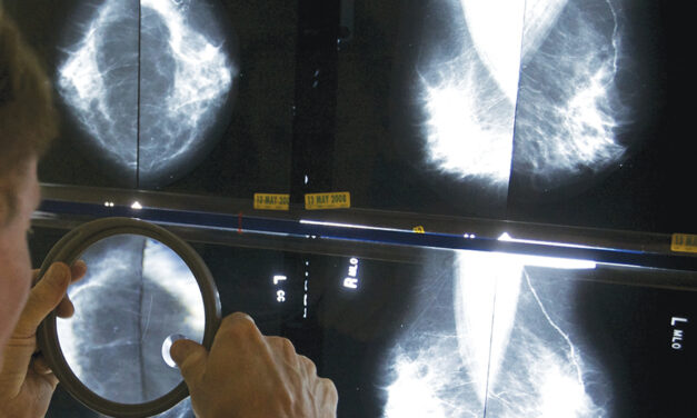 Breast Cancer Is On The Rise In Women In Their 40s. Earlier  Mammograms May Help Catch It
