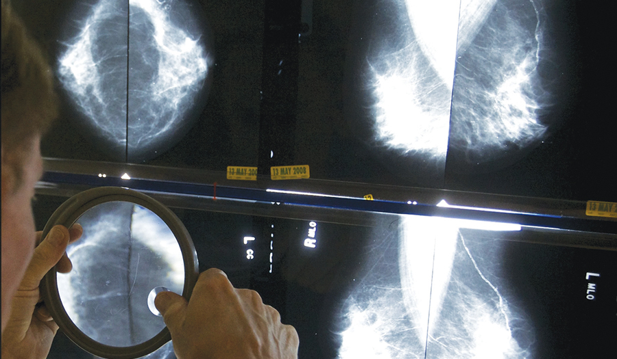 Breast Cancer Is On The Rise In Women In Their 40s. Earlier  Mammograms May Help Catch It