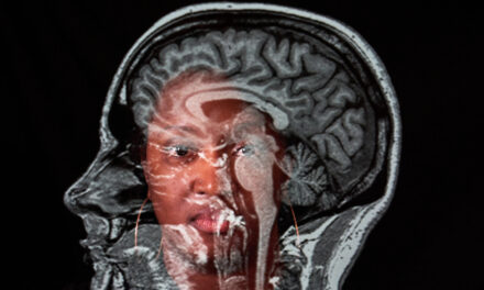 An Autoimmune Disease Stole This Man’s Memory. Here’s How He’s Learning To Cope