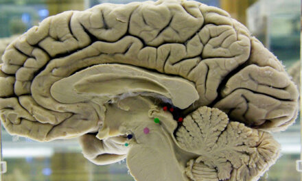 Challenging Your Brain Helps Keep It Healthy. Here’s How.