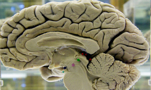 Challenging Your Brain Helps Keep It Healthy. Here’s How.