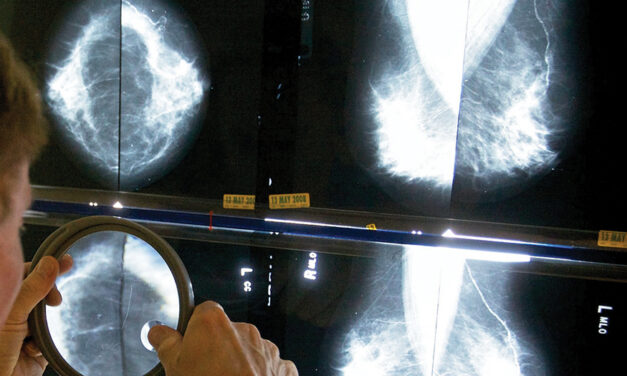 When Should You Get A  Mammogram? Conflicting  Advice Makes It Hard To Know