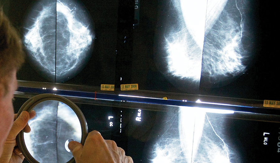 When Should You Get A  Mammogram? Conflicting  Advice Makes It Hard To Know