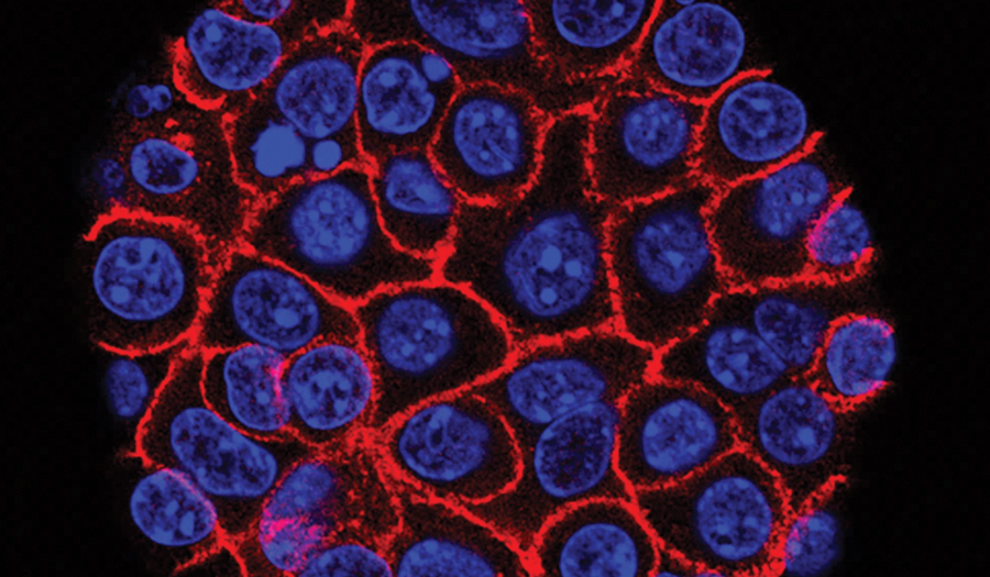 Experimental Pill Promises  New Hope For Deadly  Pancreatic Cancer