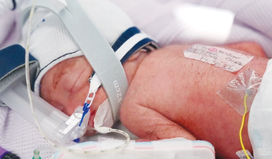 A Woman Gives Birth To Rare Identical Quadruplet Girls